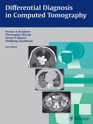 cover image of Differential Diagnosis in Computed Tomography